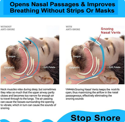 Anti-Snoring Nasal Dilator, 8 pcs